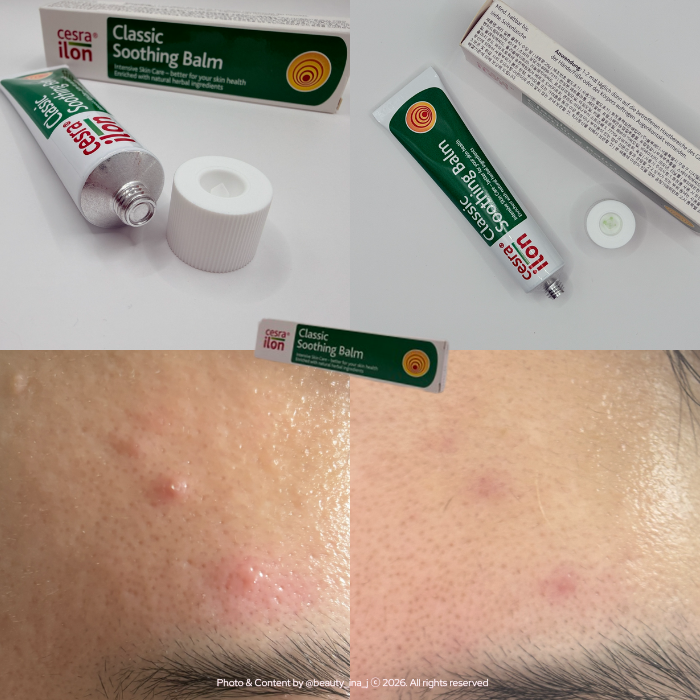 세라일론 클래식 수딩 밤 민감성 피부 써봤어요 — 일주일 뒤집어진 피부 하루밤에 진정된 ....