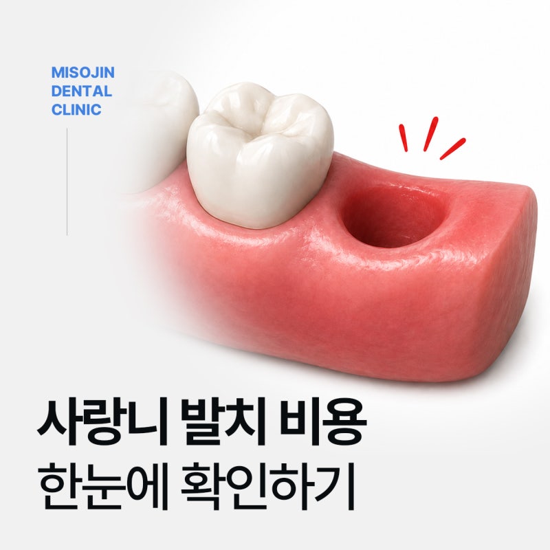 부산매복사랑니 난이도에 따른 발치 비용 총정리