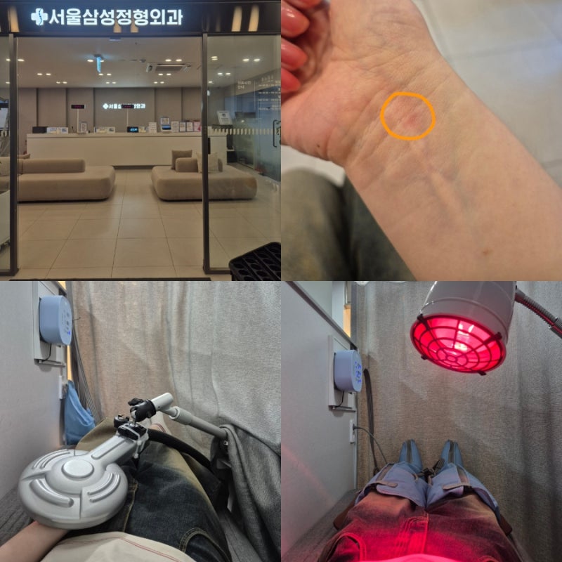 서울삼성정형외과)거제에서 유일하게 있는 근전도검사 물리치료 솔직후기