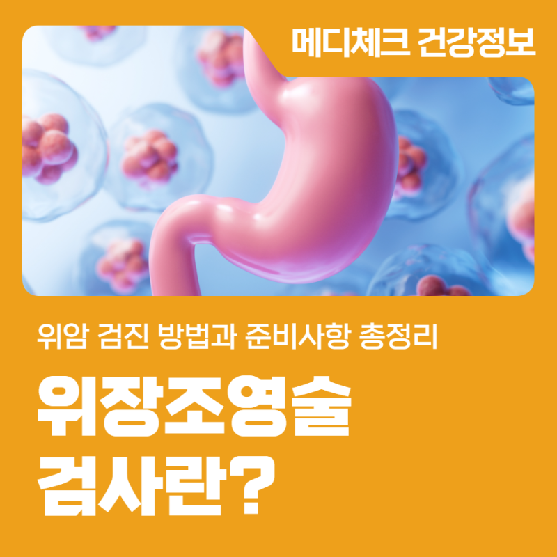 남동구 건강검진 위장조영술 검사란? 위암 검진 방법과 준비사항 총정리