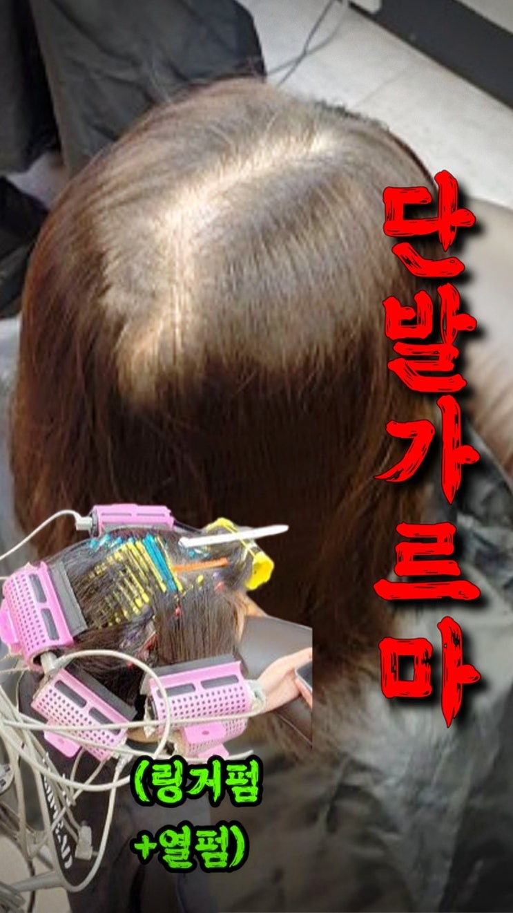  안산 가르마탈모 해결 후기! 40대 단발머리 모류교정 링거펌으로 달라진 변화