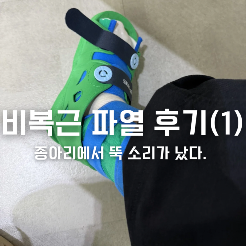 비복근 파열 후기 1탄 | 종아리에서 뚝 소리가 났다 (전조증상~ 파열 당일)