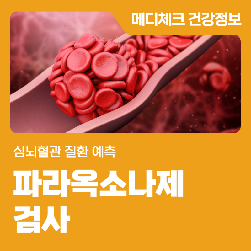 인천 건강증진협회 파라옥소나제 심뇌혈관 질환 예측하는 검사