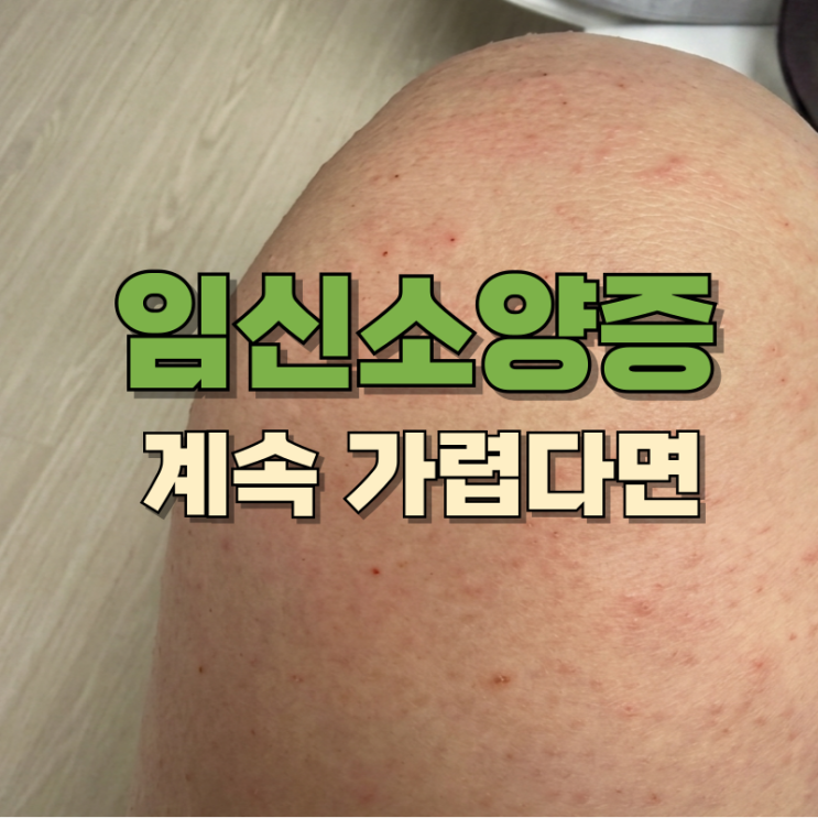  임신소양증 가려움 연고 발라도 될까 언제 나을까