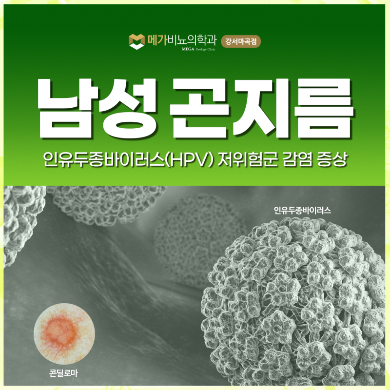 남성 곤지름 증상 초기일 때 검사해봐야 하는 이유