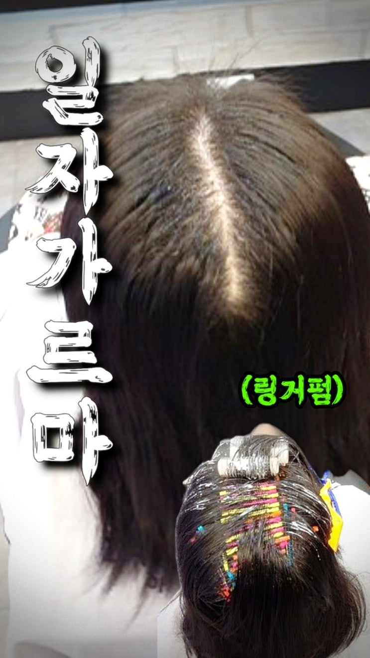  모류교정 링거펌으로 해결한 성남 긴머리 가르마 갈라짐 후기｜뒤통수까지 쩍 갈라지는 모발 교정