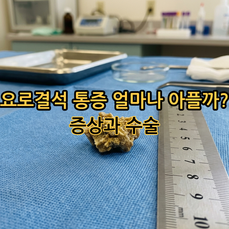 요로결석 통증 얼마나 아플까? 증상과 수술