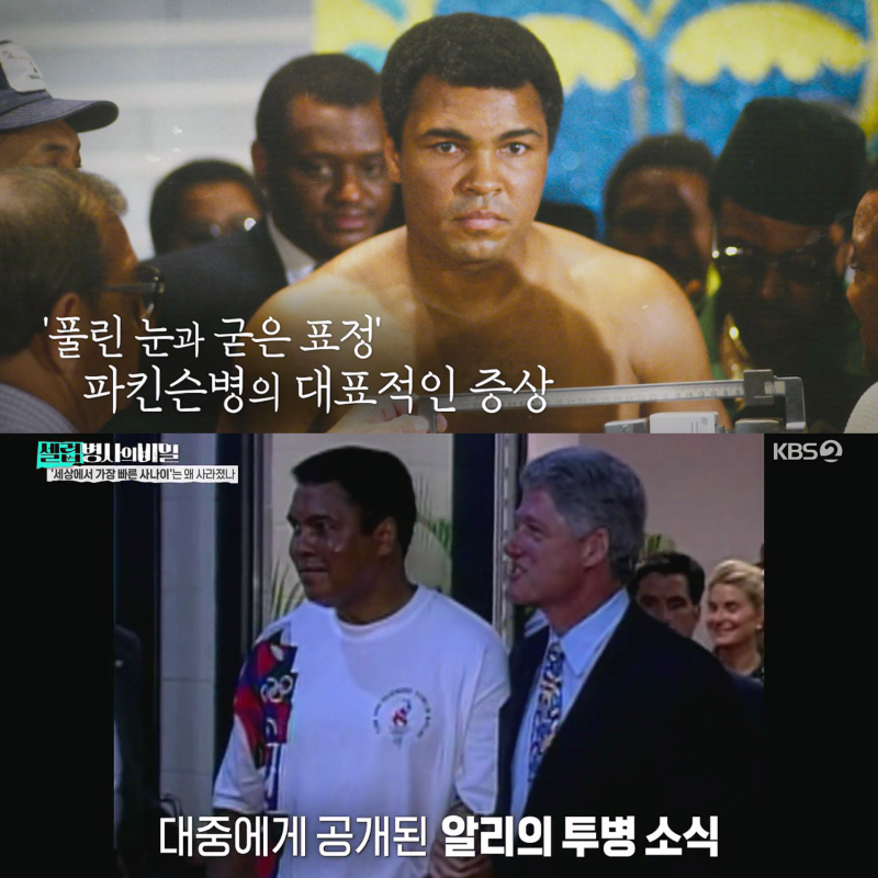 '전설의 복서' 무하마드 알리도 못 피한 파킨슨병 어떤 병이길래? (셀럽병사의 비밀)