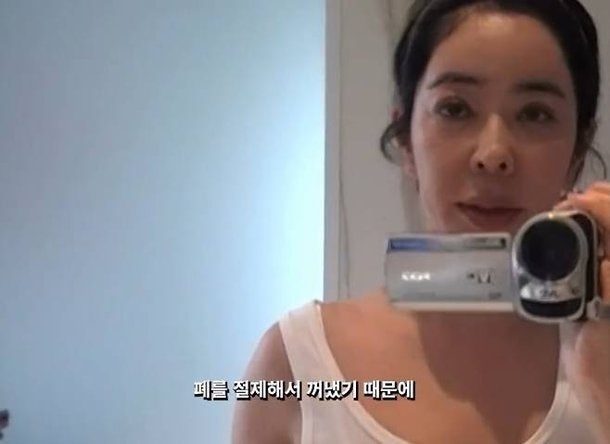 이혜영 폐암 투병 5년 근황 공개, 달라진 얼굴과 흉터 고백