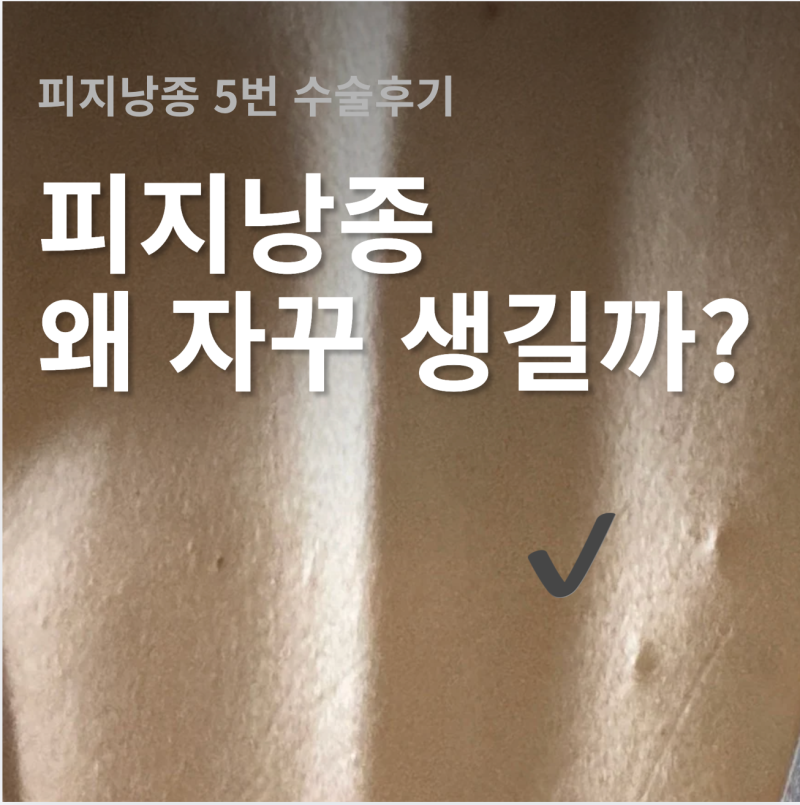 피지낭종 왜 생길까 | 5번 수술한 사람의 원인과 병원 (산부인과 외과 피부과 비급여)