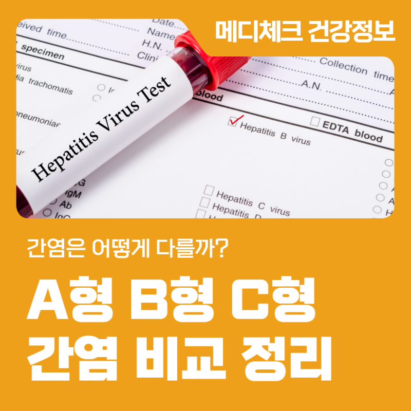 간염은 어떻게 다를까? A형 B형 C형 간염 비교 정리