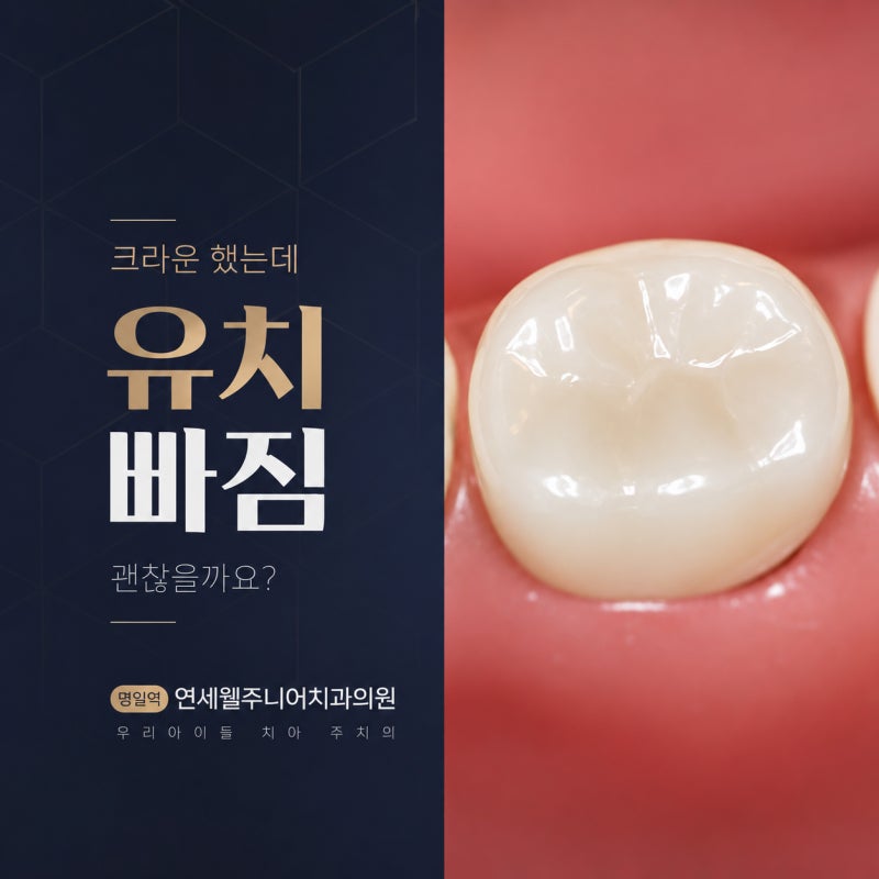 유치 크라운 흔들림, 바로 발치해야 하나요?