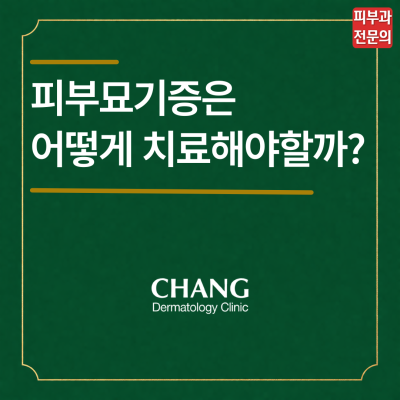 작은 자극에도 간지럽고 붓는 피부묘기증 치료법