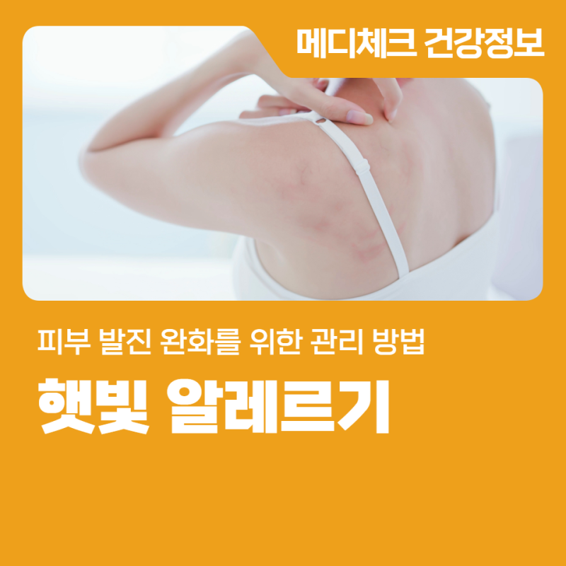 햇빛알레르기 피부 발진 완화를 위한 관리 방법