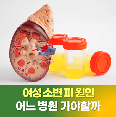 사당 비뇨기과 | 여자 소변 피 원인, 여성 소변에 피덩어리 보이면