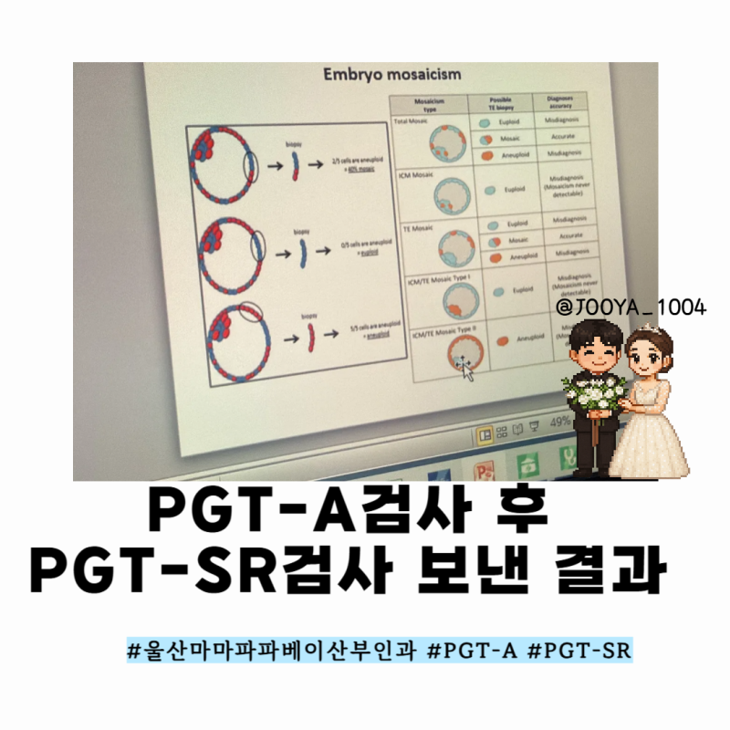 EP.23 PGT-A 검사결과와 추가로 보낸 PGT-SR 검사 비용 및 결과