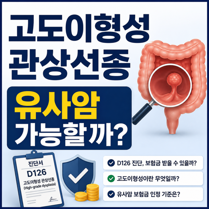 고도이형성 관상선종, 유사암 보험금 받을 수 있을까?