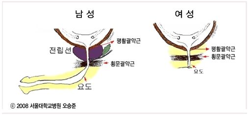 전립선암 수술 후 요실금, 얼마나 흔할까? 회복 가능성