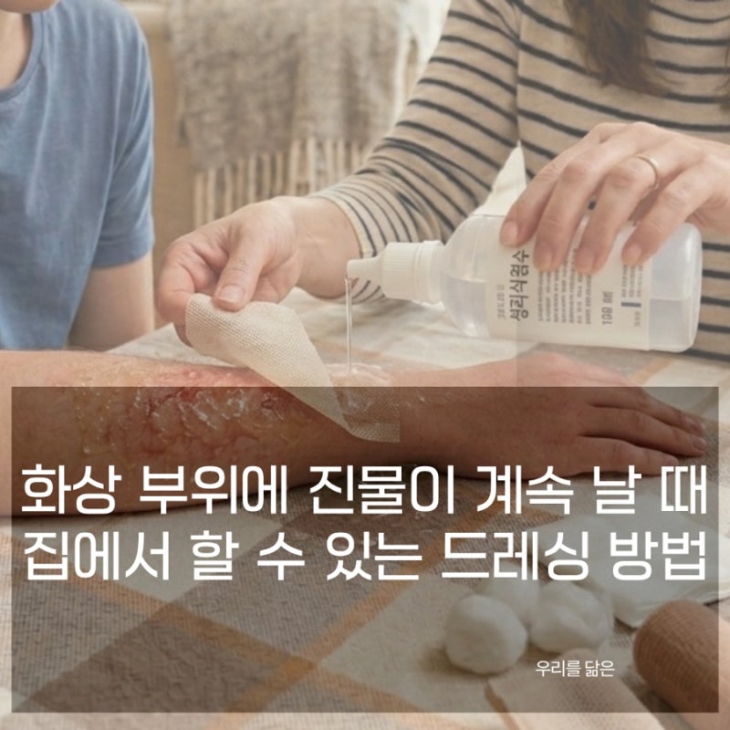 화상 부위에 진물이 계속 날 때 집에서 할 수 있는 드레싱 방법