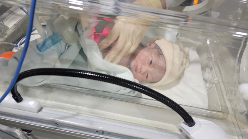 을지대병원 의정부점 제왕절개 후기(4인실)
