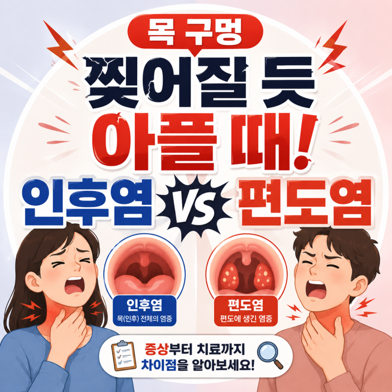 감기약 먹어도 목 통증 그대로라면? 인후염 vs 편도염 팩트 체크!