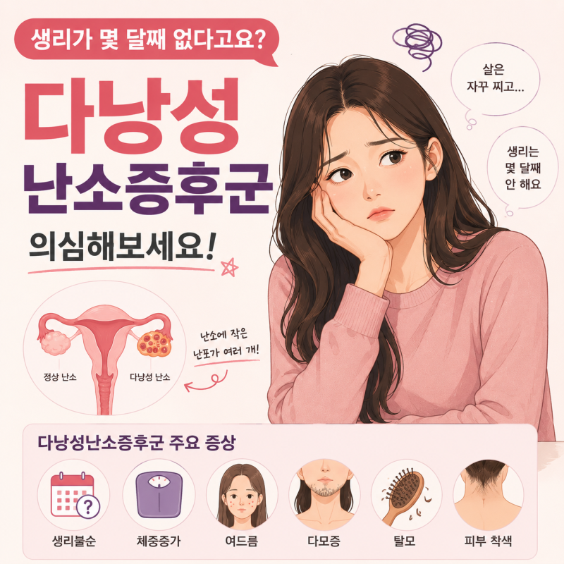 생리가 몇 달째 없다고요? 다낭성난소증후군 의심해보세요 다낭성난소증후군이란?원인은?구....