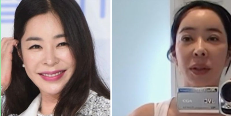 이혜영 폐암 투병 후 얼굴 몰라보게 달라진 진짜 이유는?