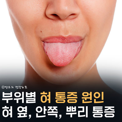 혀 옆 안쪽 뿌리 통증 원인 및 대처법은?