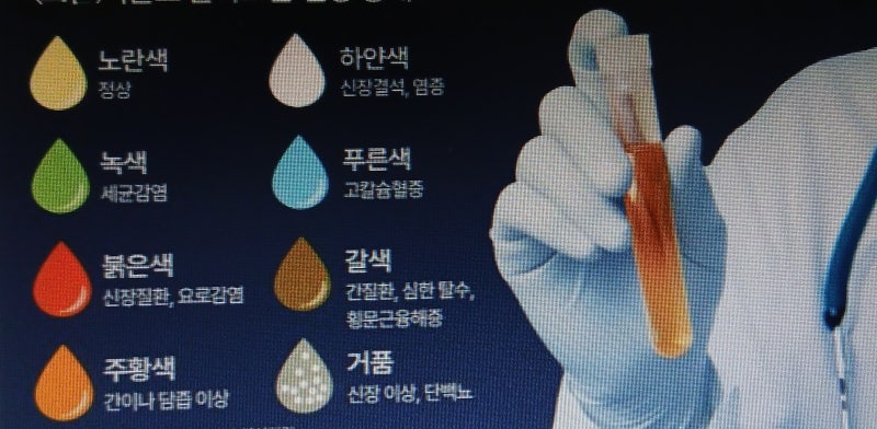 소변꿈 군중 속에서 오줌을 누고 개운했던 꿈 대박 꿈?