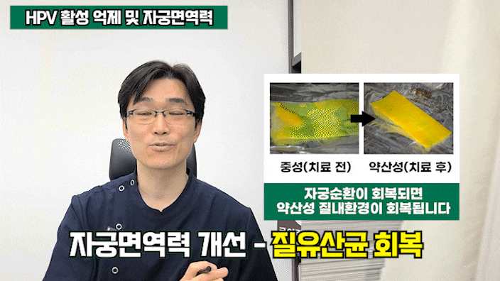HPV 16 18 고위험군 감염되었다면 암이 될까?