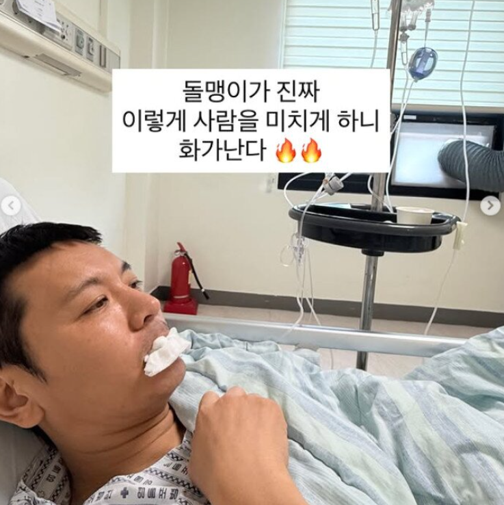  "출산급 고통이라더니 결국 수술" 정성호 응급실행 부른 요로결석, 왜 이렇게 아플까?