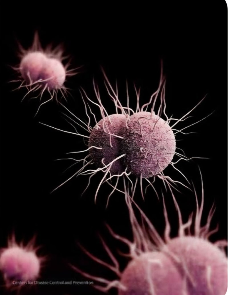여자임질증상 총정리: 냉 증가부터 골반염까지, 반드시 알아야 할 여자임질증상[Gonorrhea]
