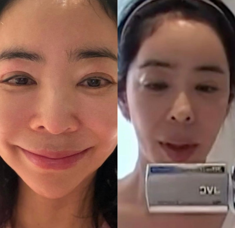 5년 암 투병 이혜영, 얼굴이 달라진 진짜 이유