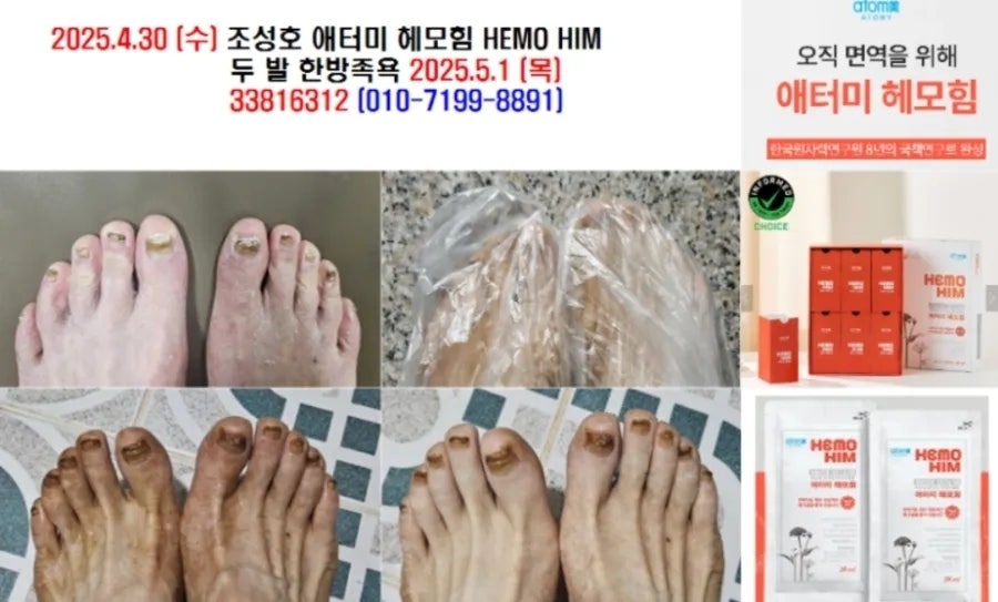 천궁 사진 5