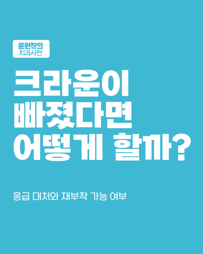씌운 크라운이 빠졌다면? 응급 대처와 재부착 가능 여부