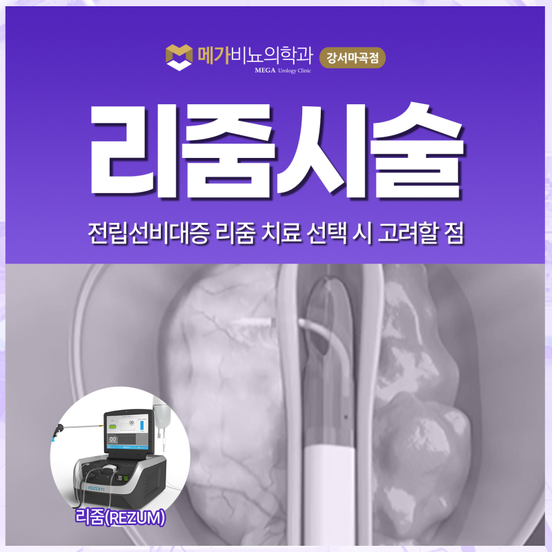 전립선비대증 치료 방법으로 리줌시술 선택할 때 따져볼 점