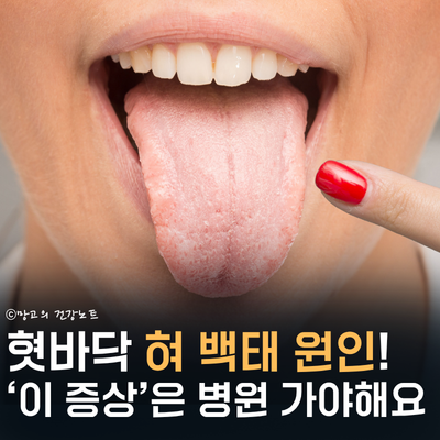 혓바닥 혀 백태 원인 및 제거 방법 주목하세요!