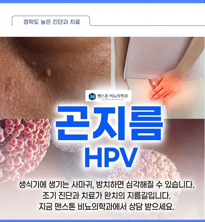 HPV바이러스 백신주사 가다실9가