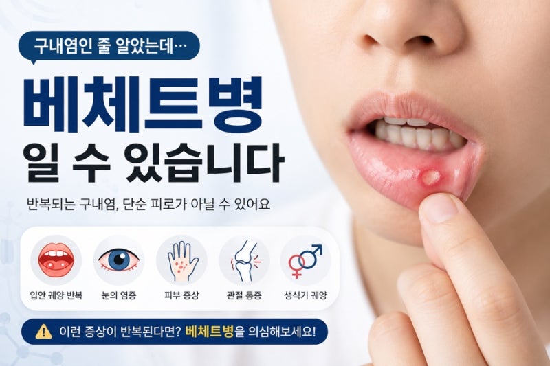 구내염인 줄 알았는데..베체트병일 수 있습니다