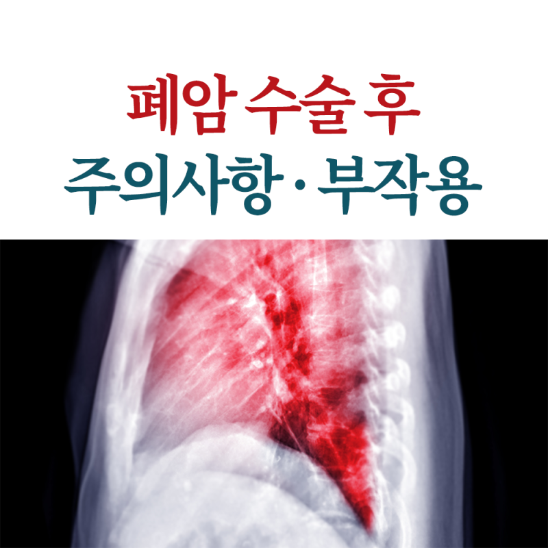 폐암 수술 후 부작용 및 주의사항