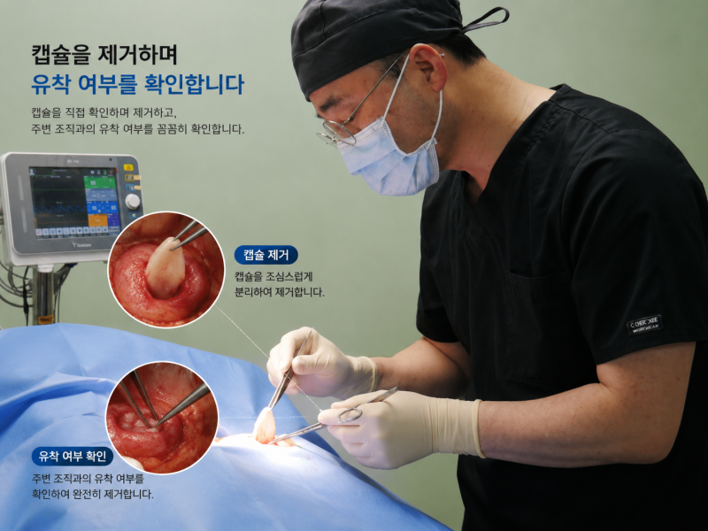 안산 피지낭종 제거할 때 '이것' 확인하세요!