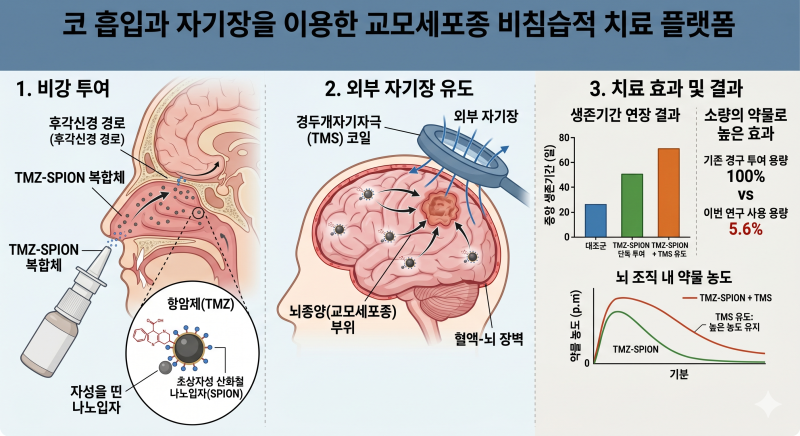 코로 흡입하는 뇌종양 치료제...교모세포종 생존기간 최대 2.7배로 연장