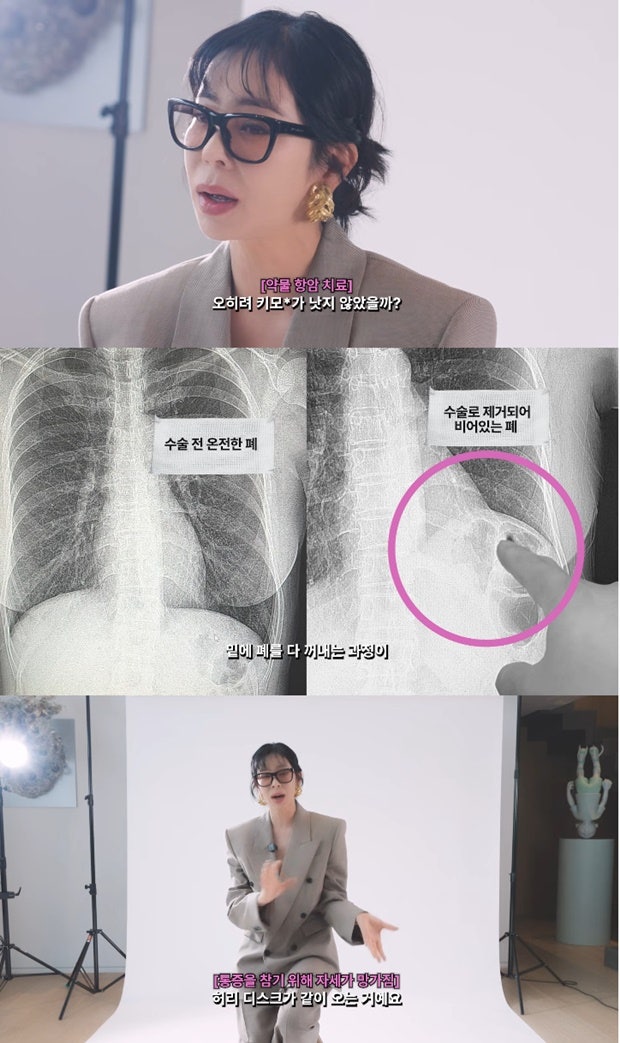이혜영 “10년 전 프로필 속 걔는 없다”…암 투병 6년이 남긴 솔직한 고백