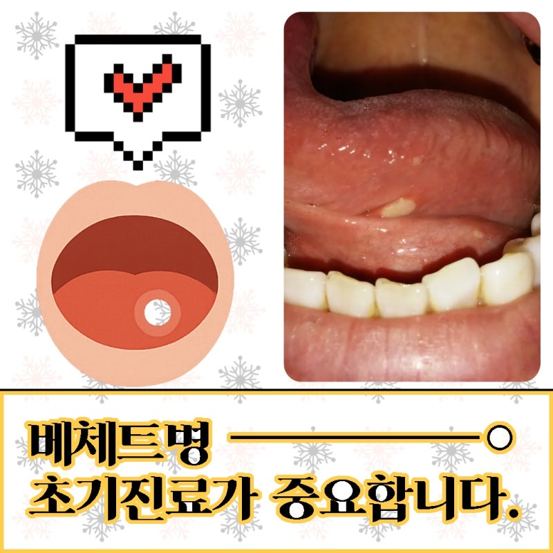 자가면역질환뜻 내 몸을 공격하는 면역 체계의 이상 반응 알기
