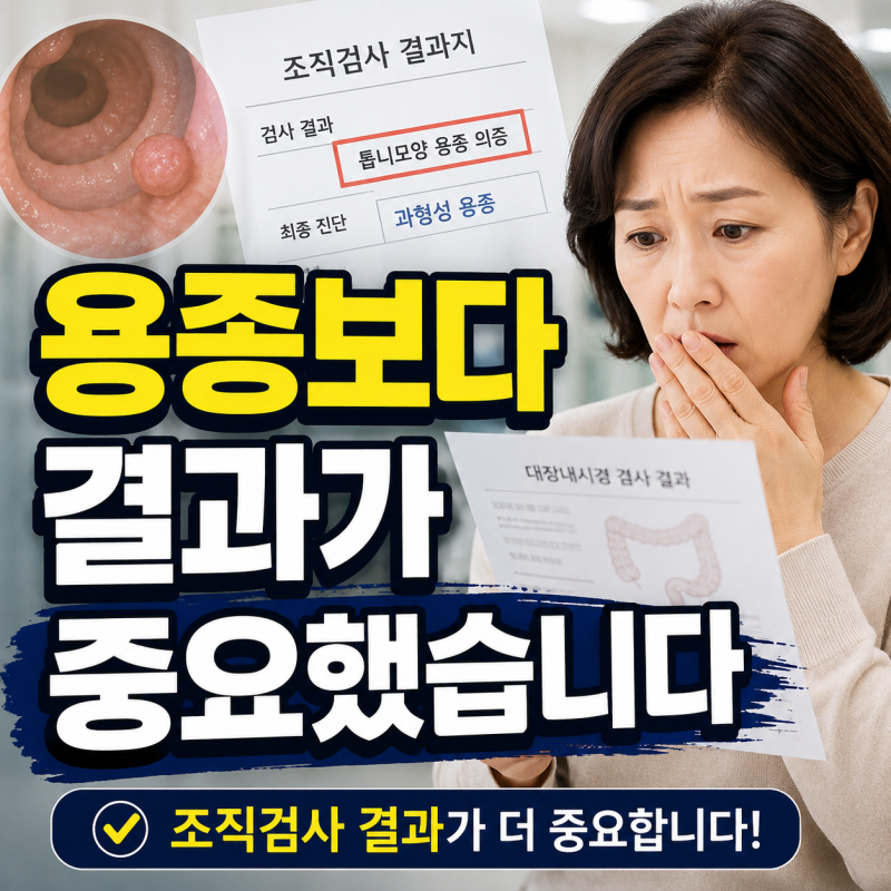 대장용종 나왔다고 암 아닙니다｜조직검사 결과가 더 중요합니다