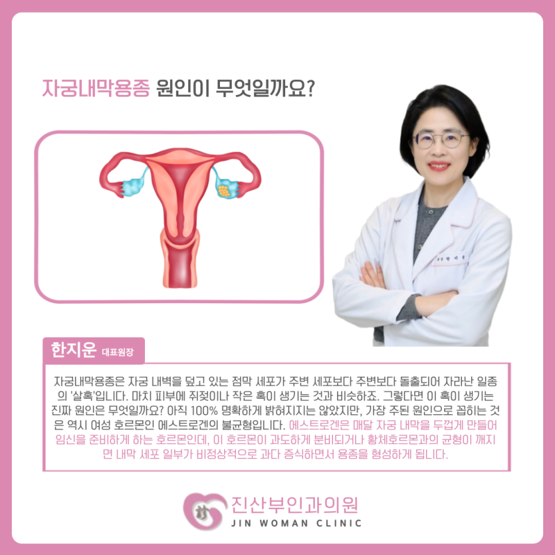 생리 기간 아닌데 피가? 자궁내막용종 증상 성내동 산부인과