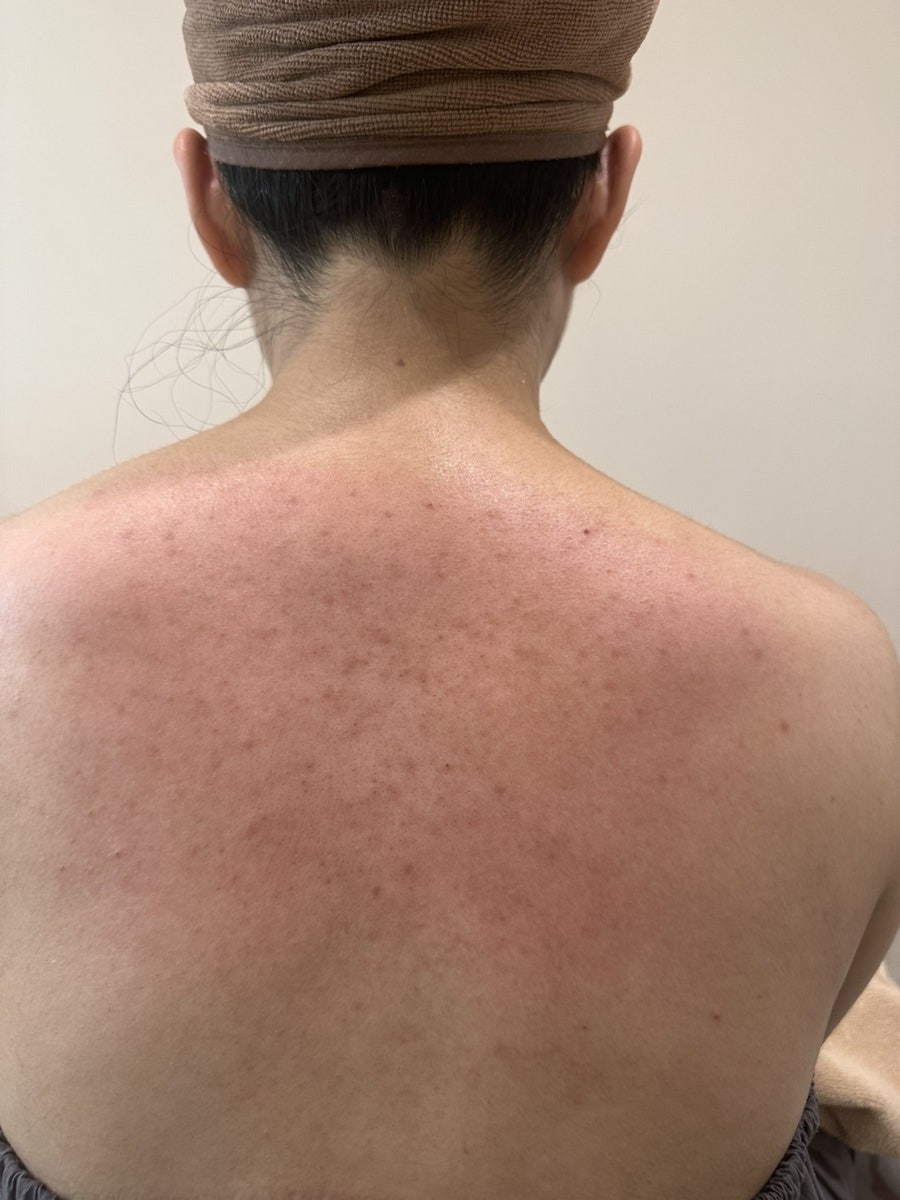 바르다피부 사진 3