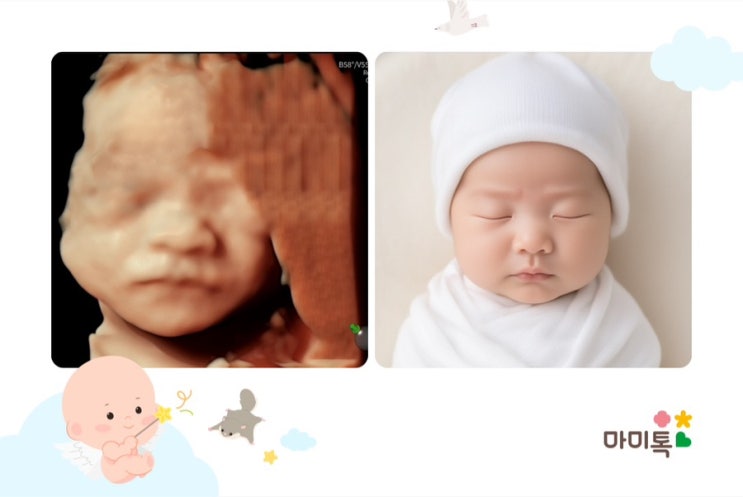  [임신중기] 22주 ~ 25주 후기 / 아인병원 임당검사 통과! / 입체초음파 얼굴 사진 후기