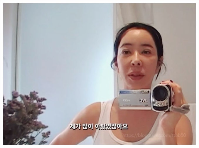  이혜영 5년 암 투병 고백, 폐 절제 수술 흉터와 눈 붓기의 충격적인 진실