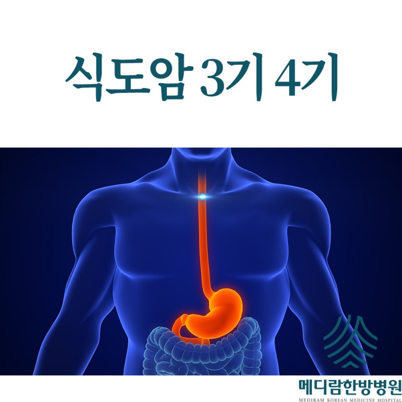 식도암 3기 4기 기수별 치료 및 관리 방법은